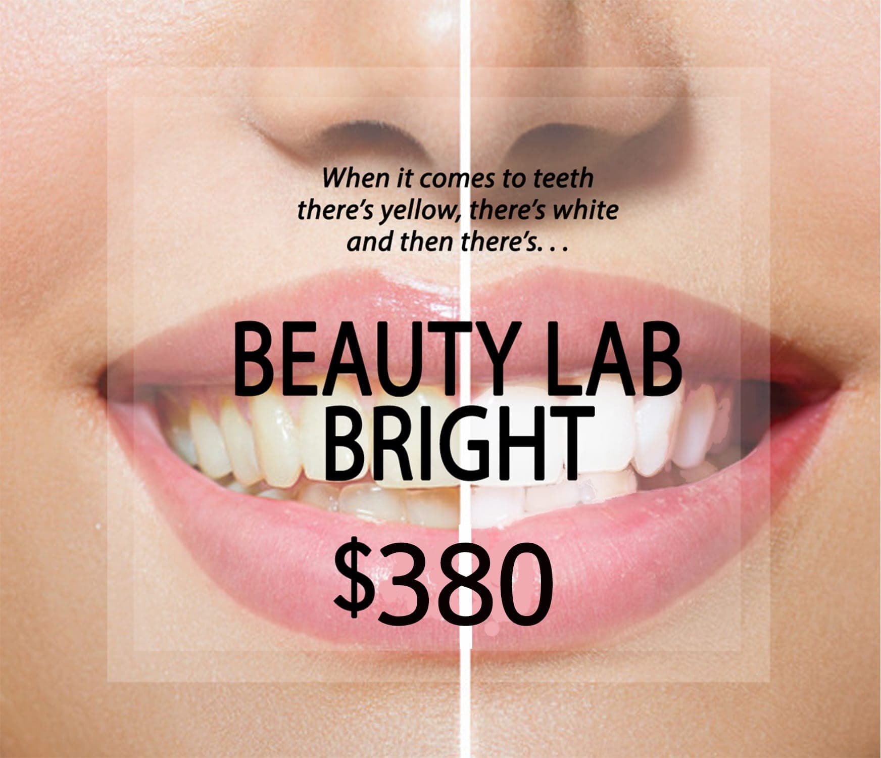 Beauty Lab Bright Teeth Whitening Full Treatment