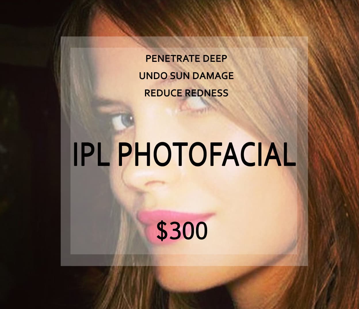 IPL Photofacial product card.