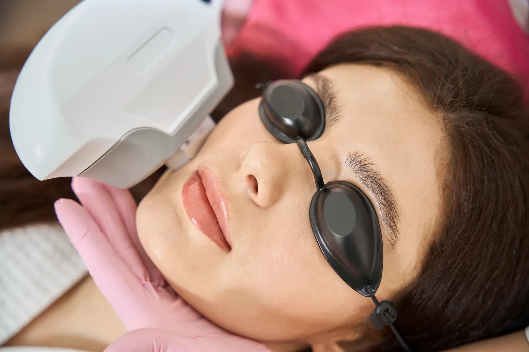 IPL Photofacial treatment media.