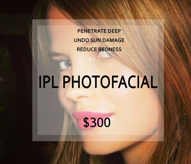 IPL Photo Facial Price Template | Beauty Lab + Laser in Murray & Riverton, UT