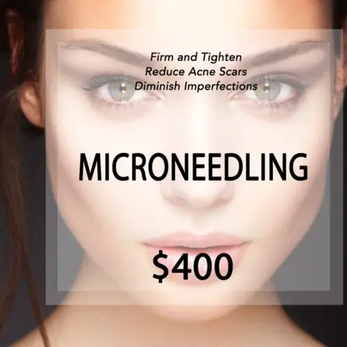 Microneedling Treatment | Beauty Lab + Laser in Murray & Riverton, UT Microneedling Treatment | Beauty Lab + Laser in Murray & Riverton, UT