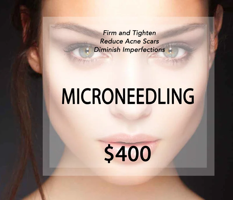 Microneedling Treatment Price Template | Beauty Lab + Laser in Murray & Riverton, UT