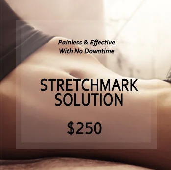 Stretchmark Solution