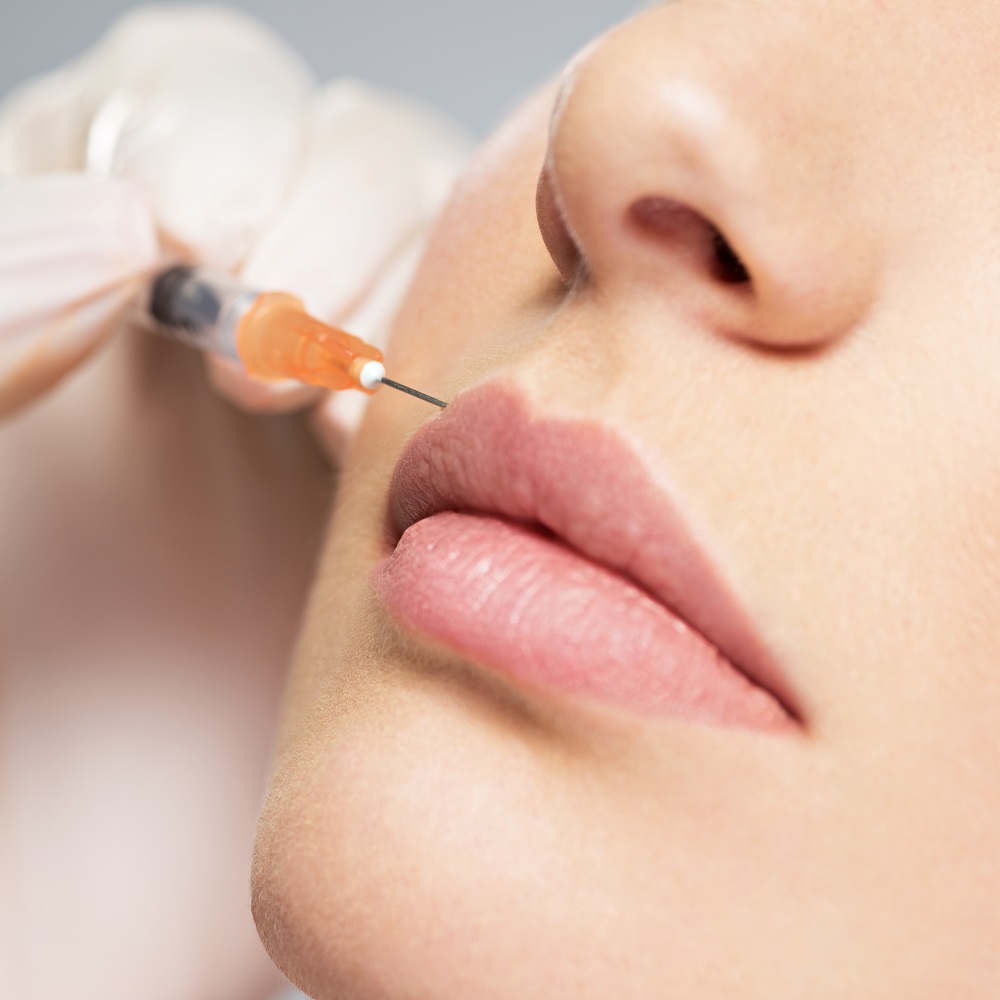 Botox Lip Flip Salt Lake City Ut Beauty Lab And Laser